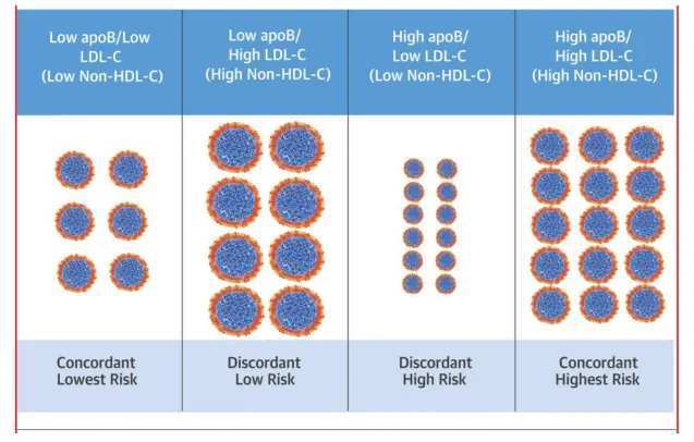 ApoB vs LDL discordance