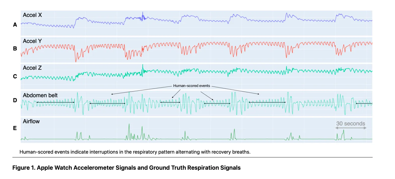 Apple Watch accelerometer for sleep apnea